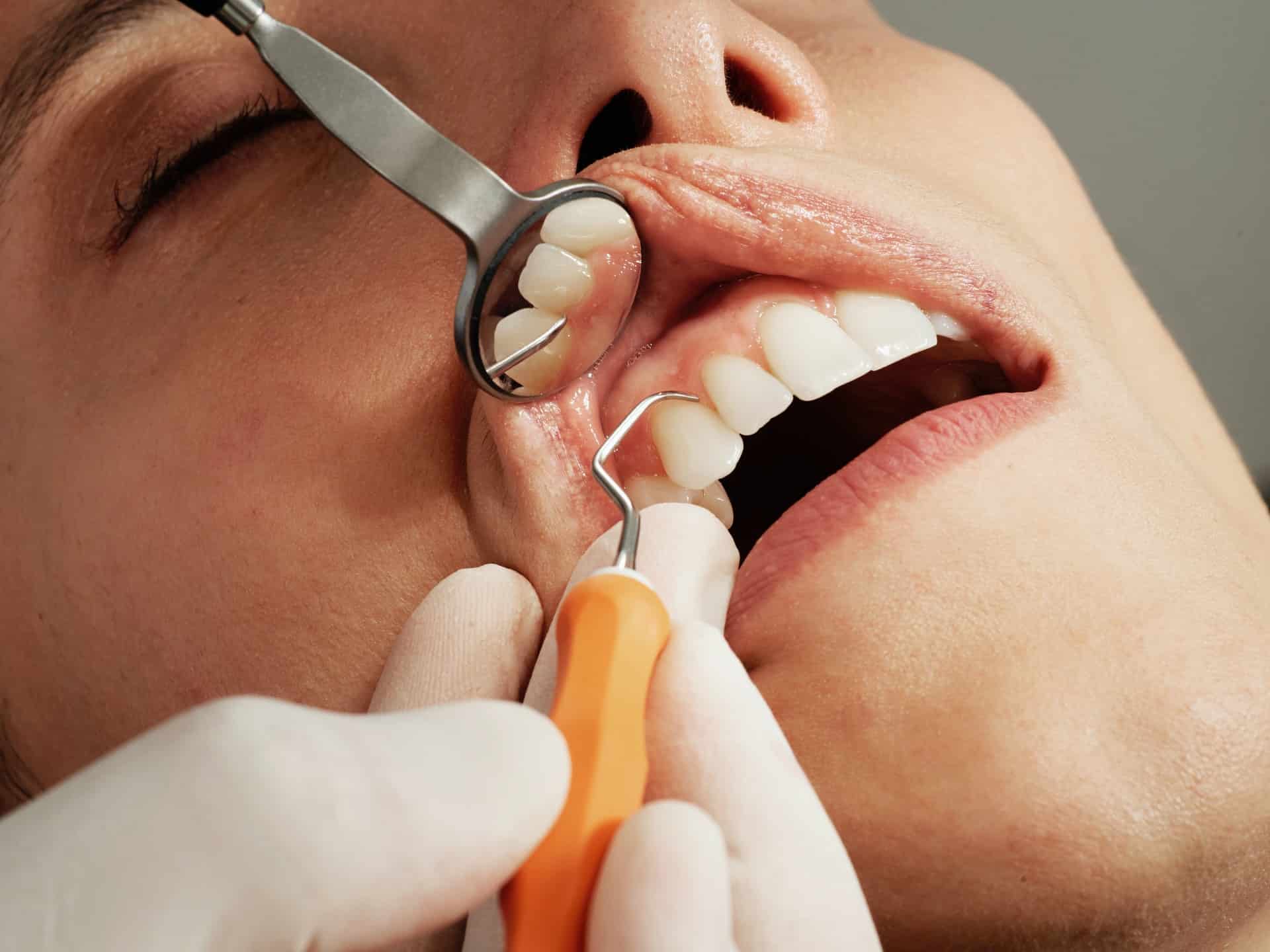 Quand devez-vous consulter un dentiste ?
